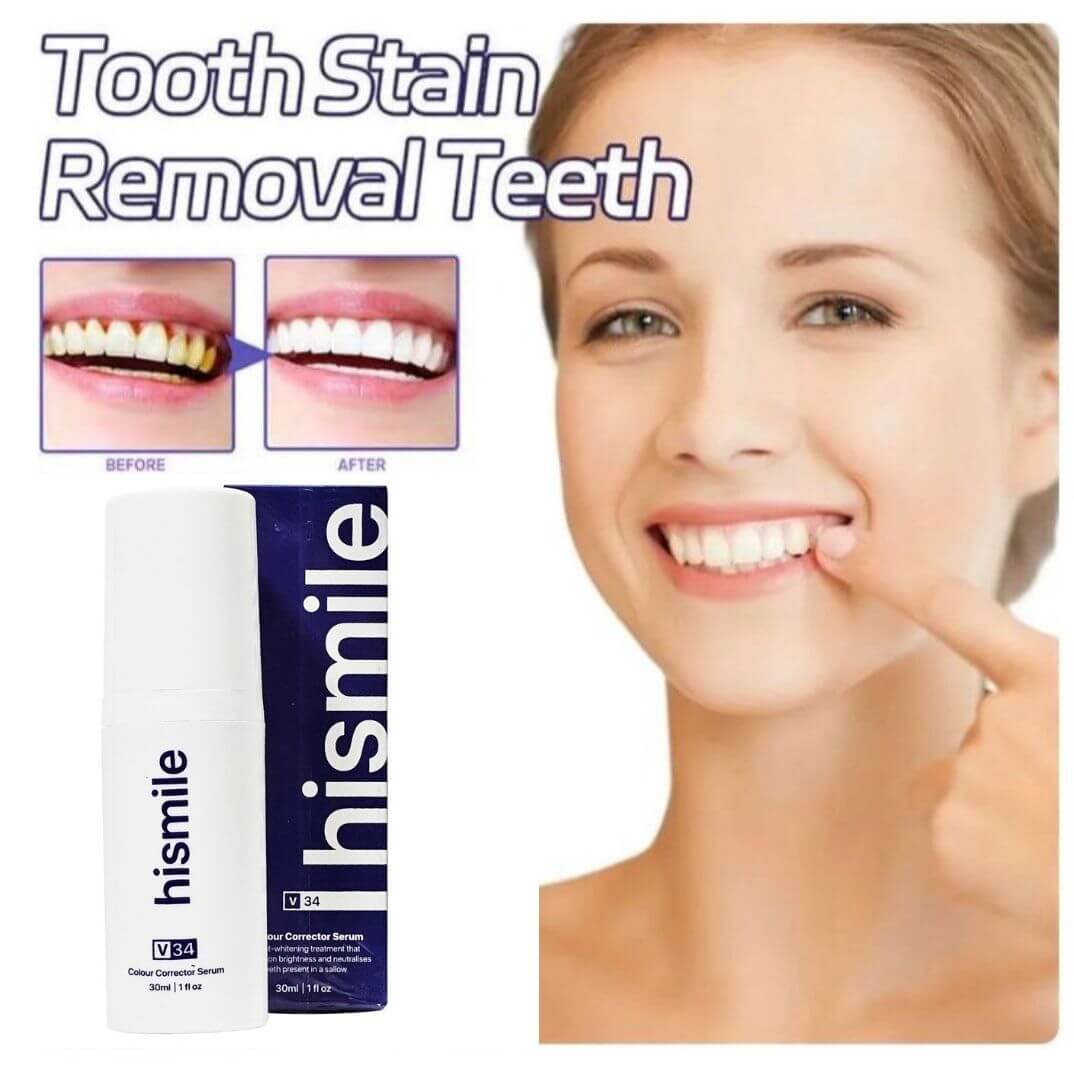 🟣 SmileBright V34 – Espuma Blanqueadora Instantánea