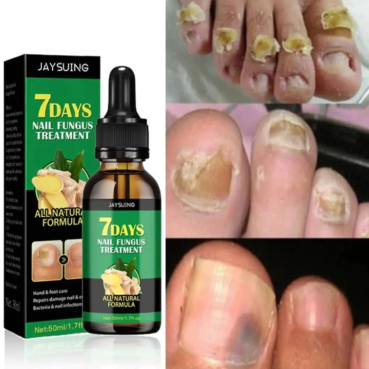 NailBoost 7D: Uñas Fuertes en Solo 7 Días