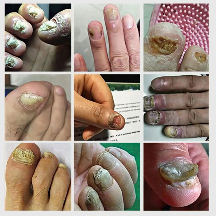 NailBoost 7D: Uñas Fuertes en Solo 7 Días