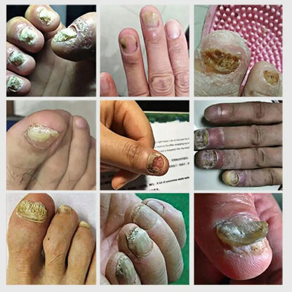 NailBoost 7D: Uñas Fuertes en Solo 7 Días
