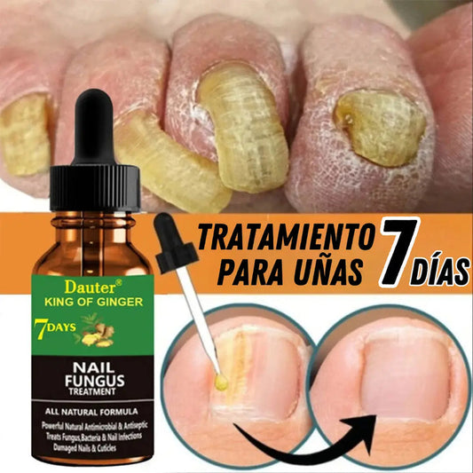 NailBoost 7D: Uñas Fuertes en Solo 7 Días